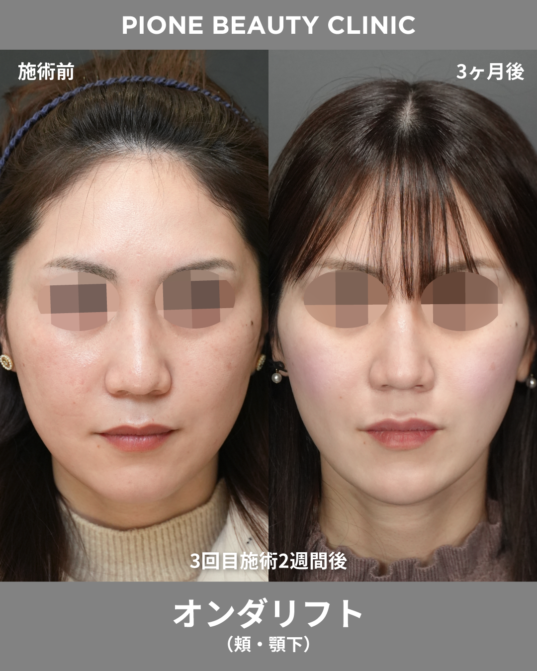 症例画像