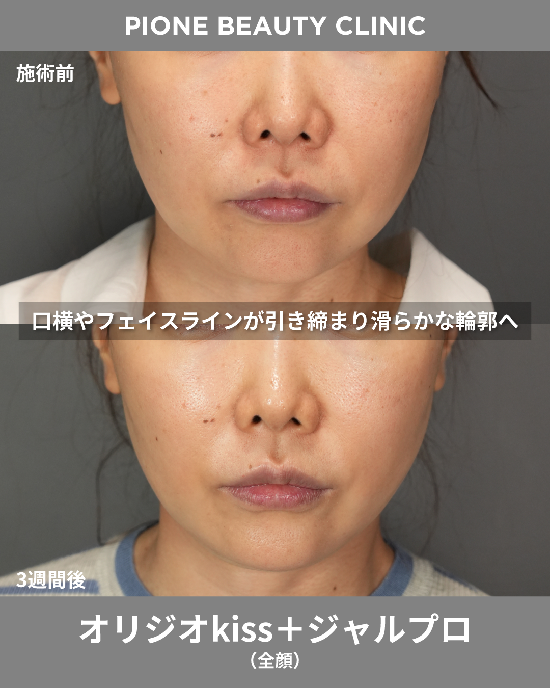 症例画像