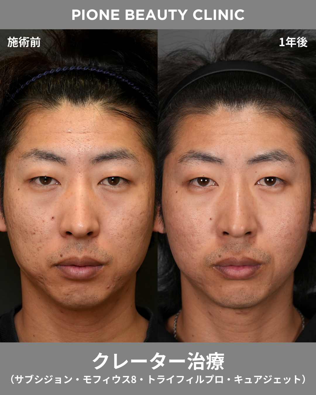 症例画像