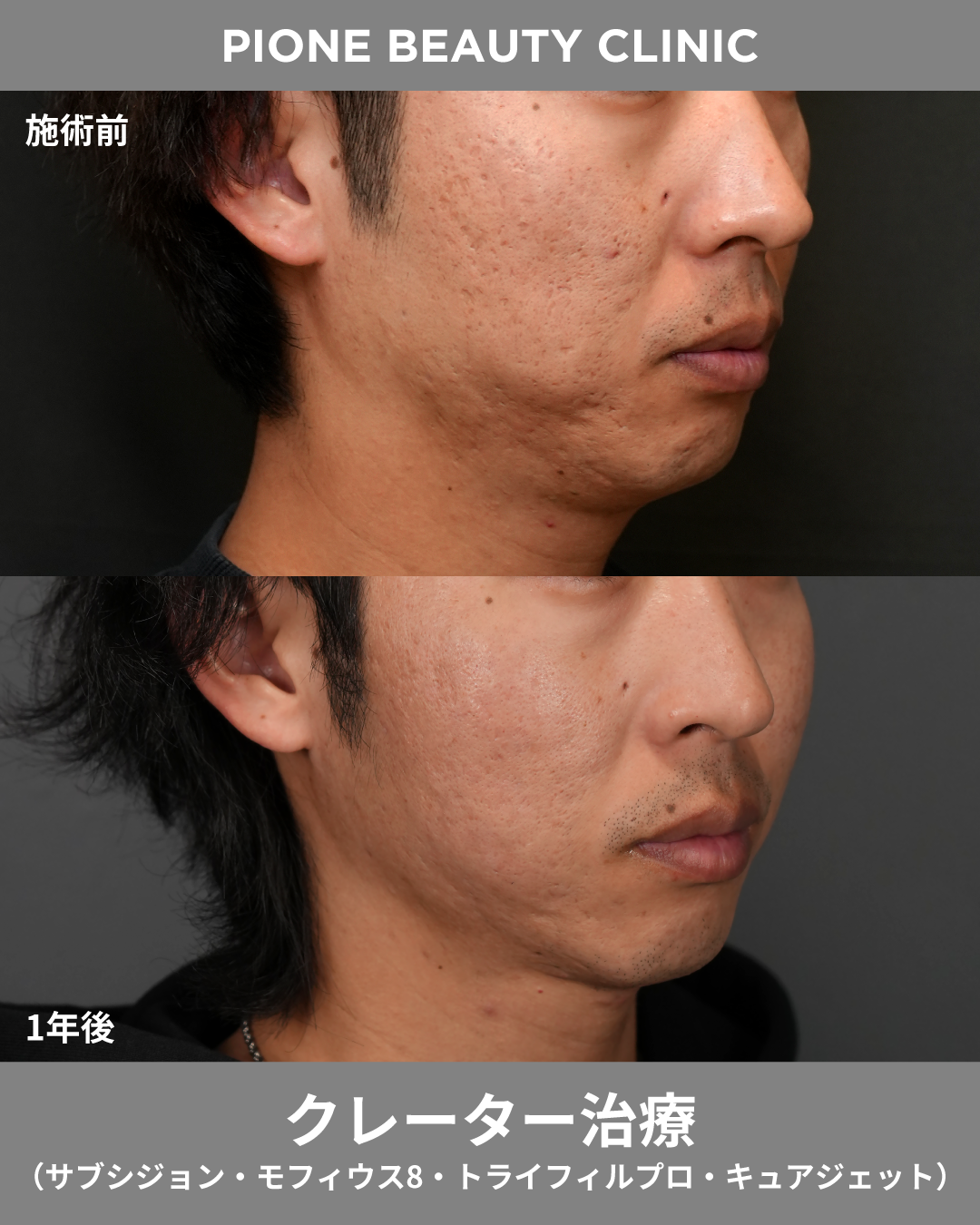 症例画像